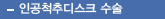 인공척추디스크 수술